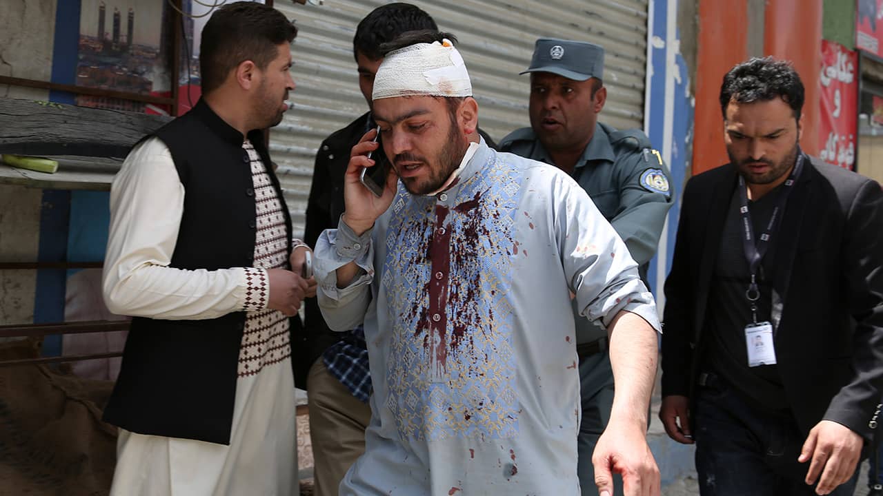 Photo of an injured man talking on the phone after the explosion in Kabul