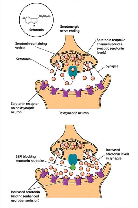 Photo of SSRIs chart