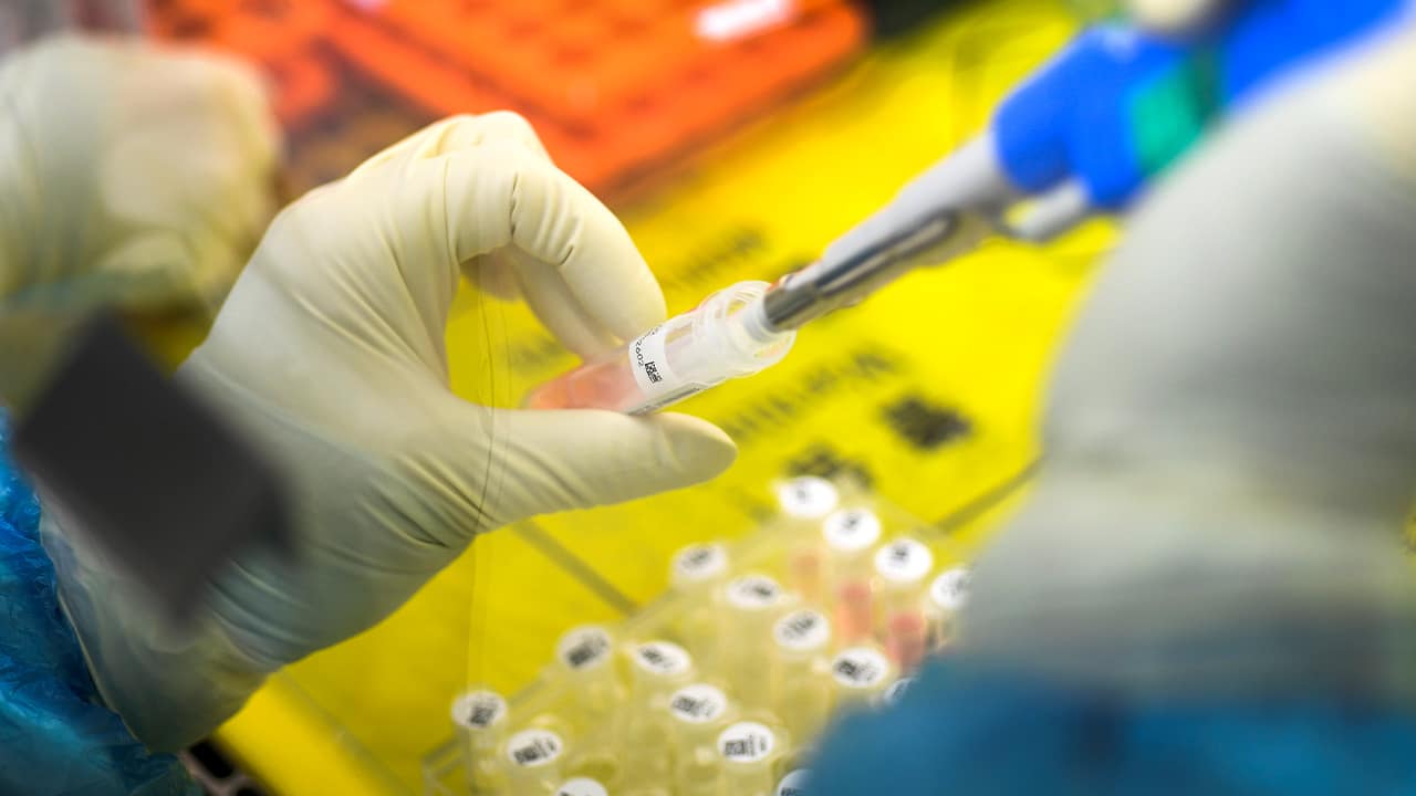 Photo of an employee working with a nucleic acid test on 2019-nCoV in Wuhan